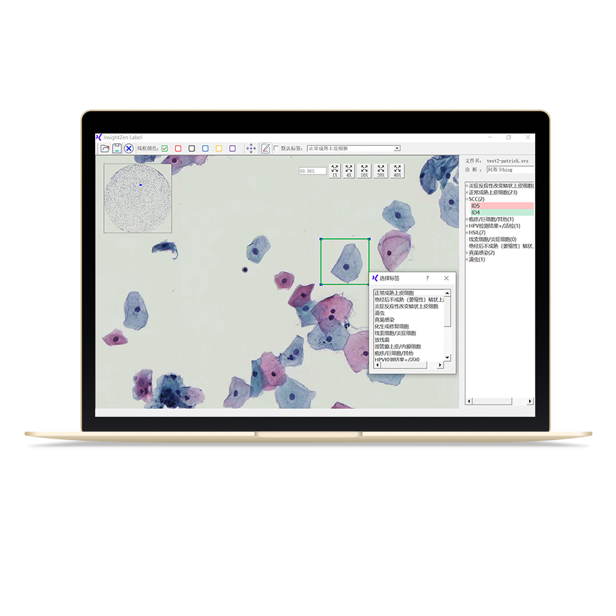 【杭州医策】PathoLabel 标注工具-云医购